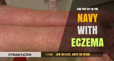 Joining the Navy with Eczema: Eligibility, Challenges, and Solutions