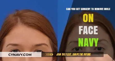 Facial Mole Removal Surgery: Options for Navy Personnel Explained
