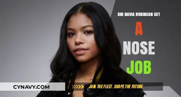 Navia Robinson's Nose Transformation: Fact-Checking Plastic Surgery Rumors