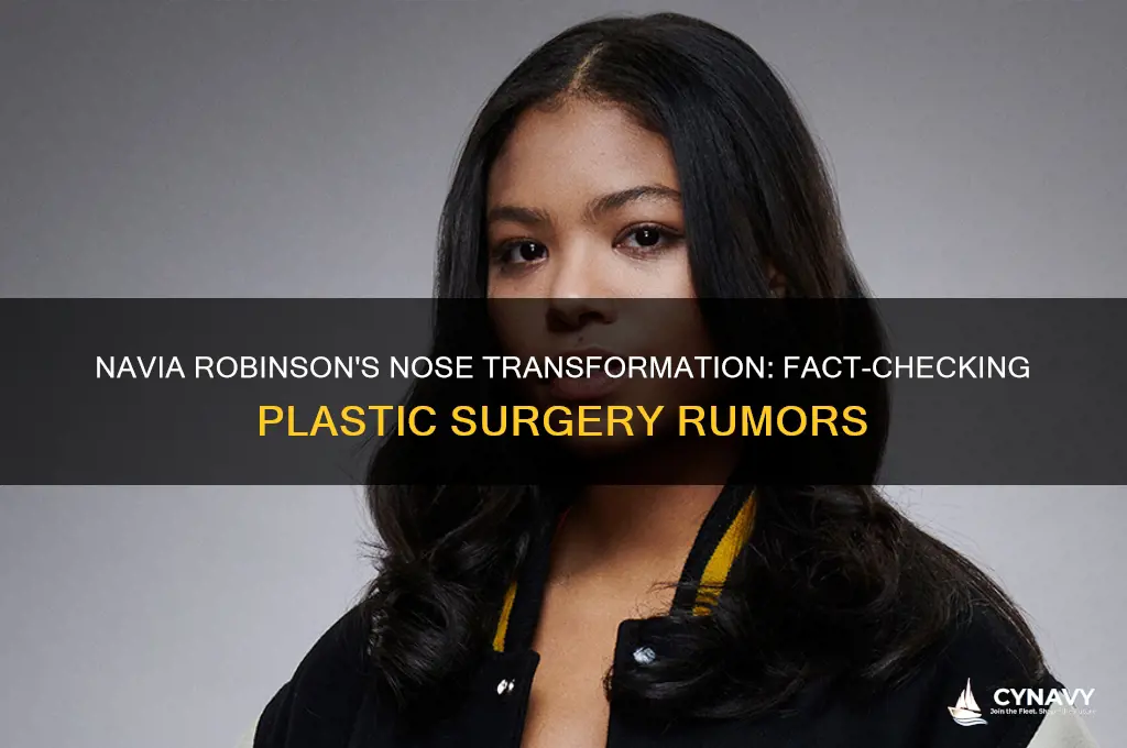 did navia robinson get a nose job