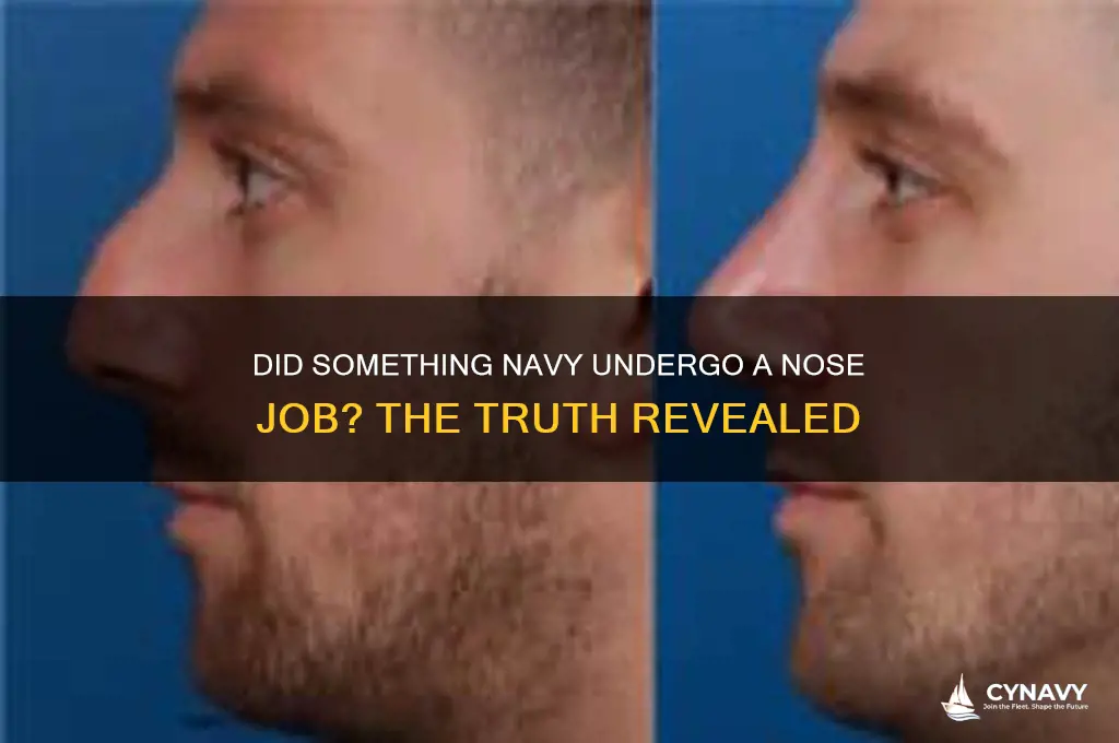did something navy get a nose job