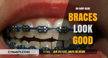 Enhancing Smiles: The Aesthetic Appeal of Navy Blue Braces