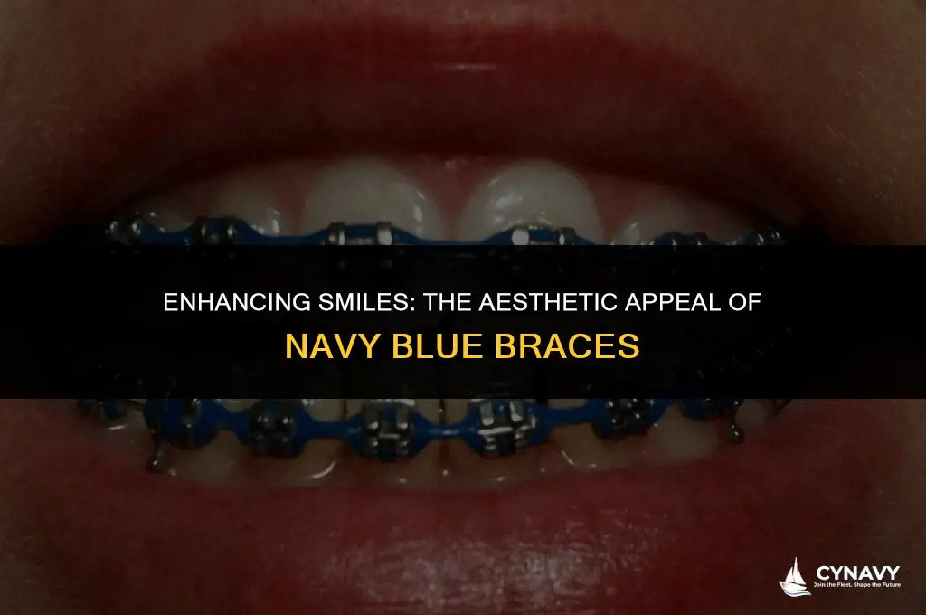 do navy blue braces look good