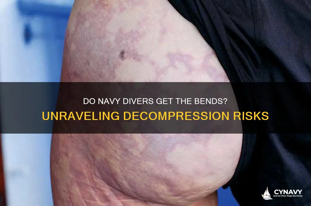 do navy divers get the bends