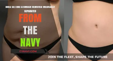 Stomach Removal and Navy Medical Separation: What You Need to Know