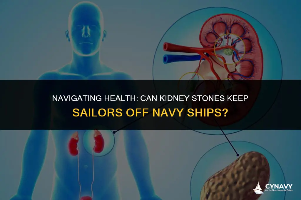 does kidney stone prevent sailors to go to navy ships