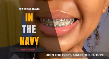 Navy Braces Guide: Steps to Straighten Your Smile While Serving