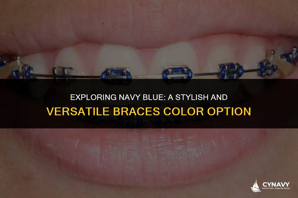 is navy a good braces color
