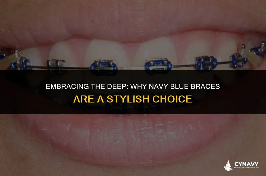 is navy blue a good color for braces