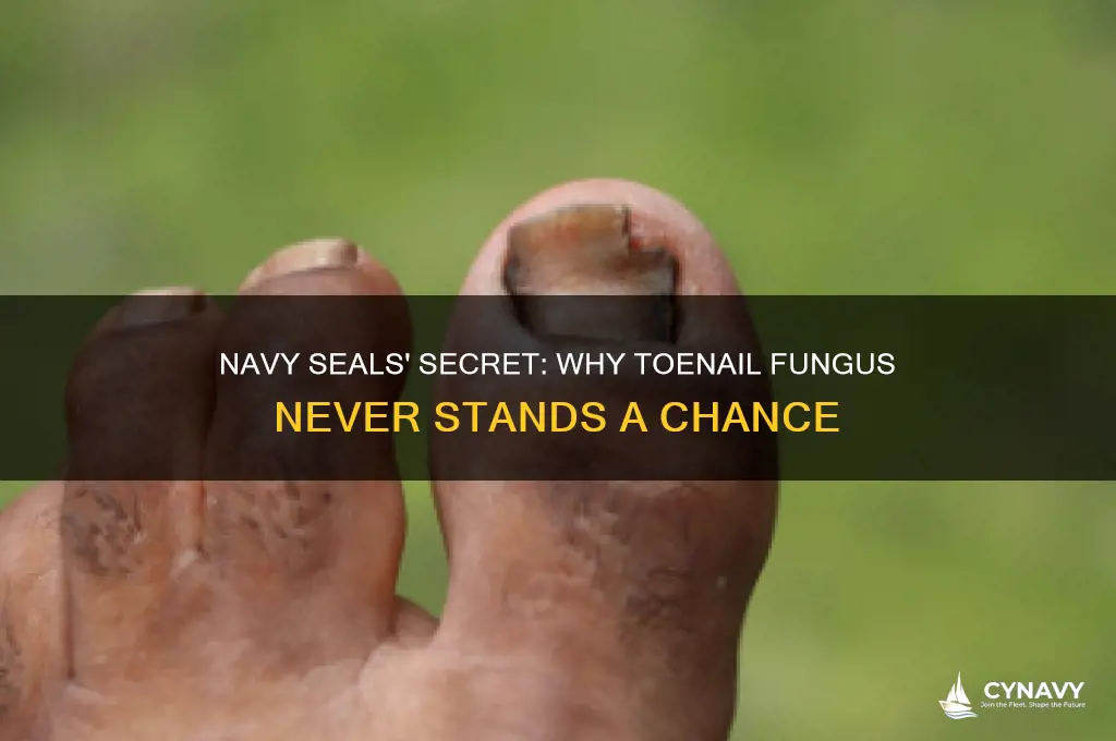 why navy seals never get toenail fungus