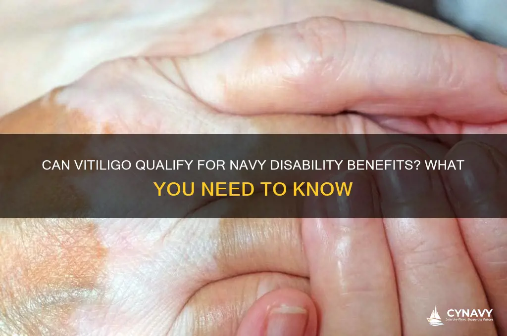 will i get disability for vitiligo navy