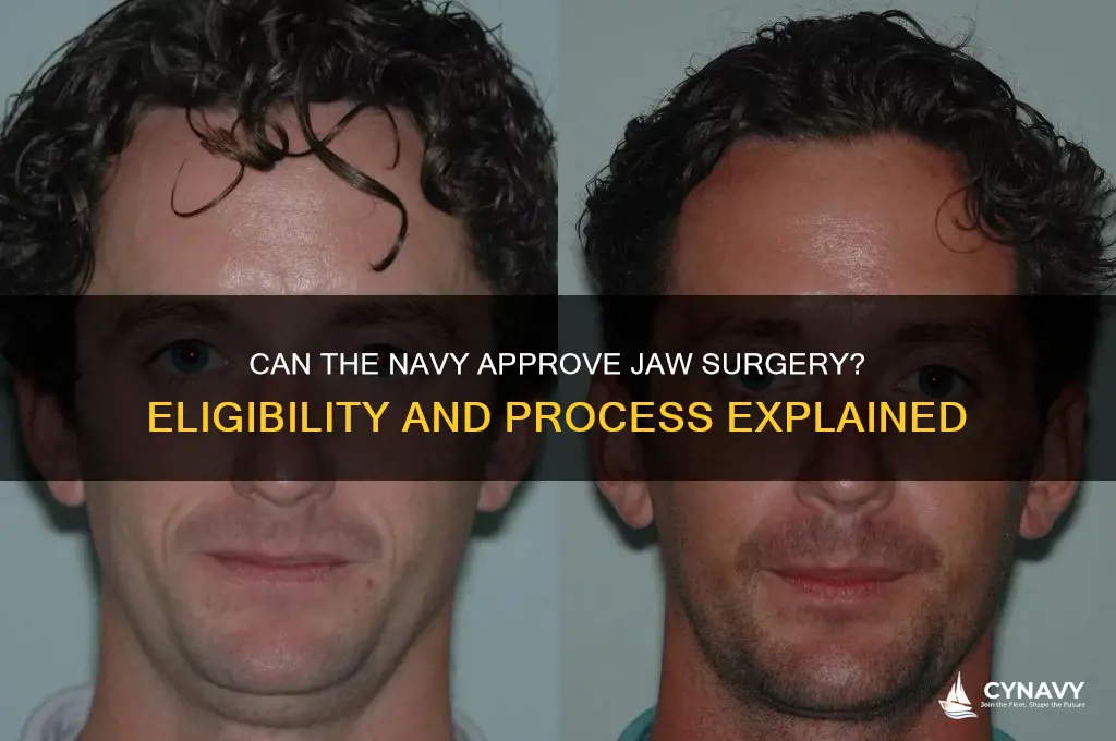 will the navy let you get jaw surgery